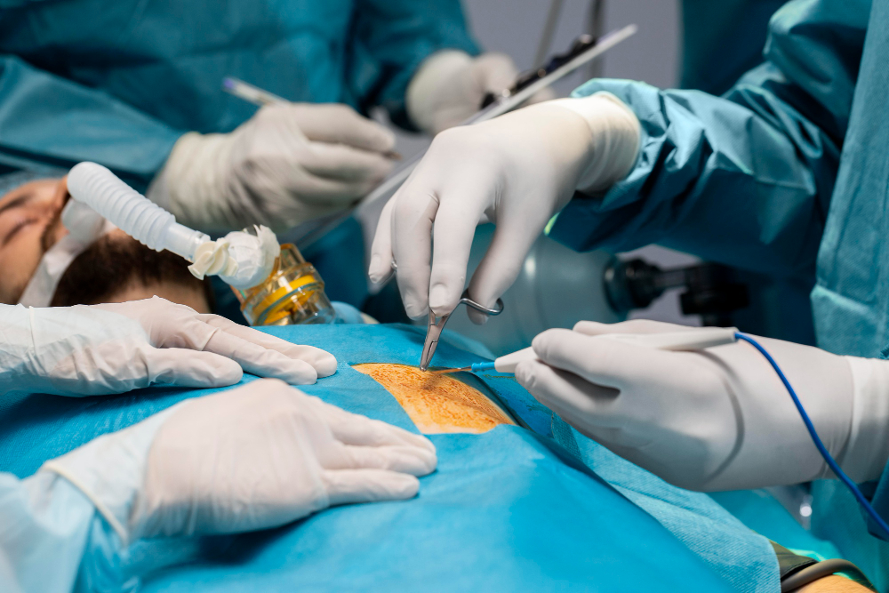 Laparoscopic Surgeries