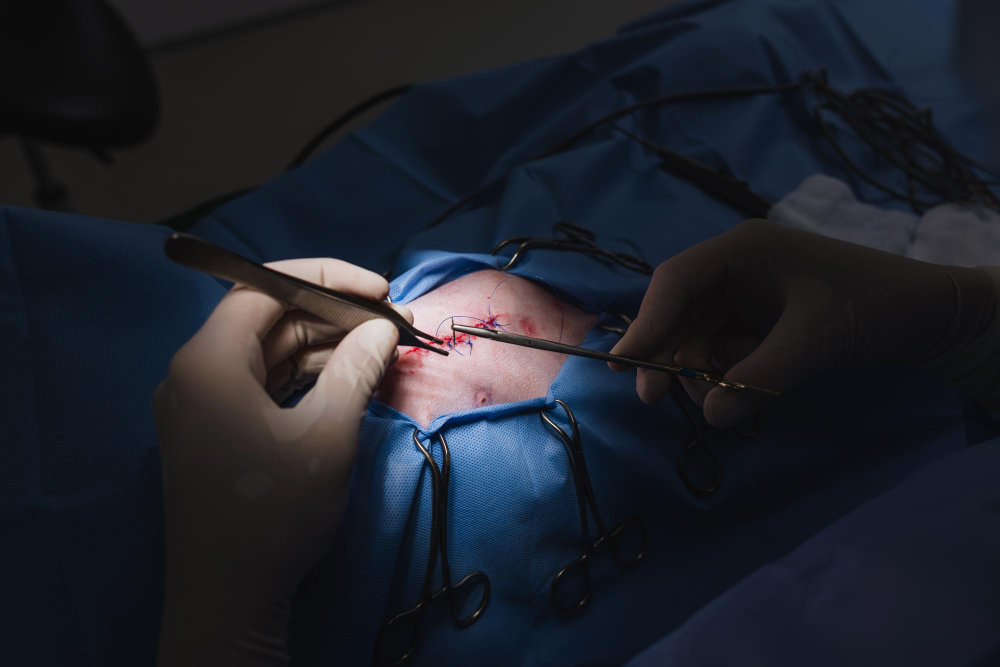 Laser Treatment Procedure